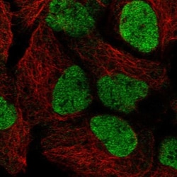 SmarcAL1 Antibody, Novus Biologicals 25 &mu;L, Unlabeled:Antibodies, Polyclonal
